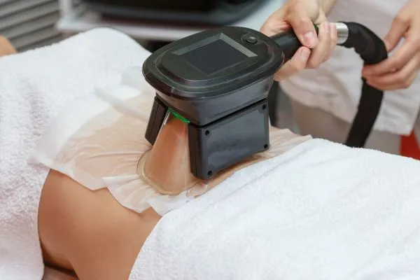 Image of person having fat freezing treatment to help weight gain Alcester