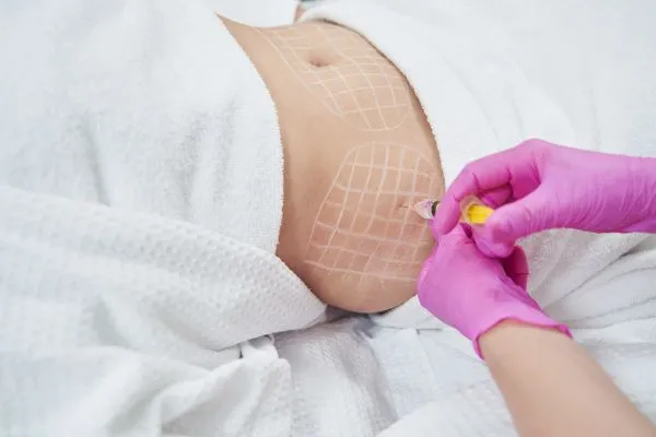 image of fat dissolving injections on love handles to help combat weight gain Alcester
