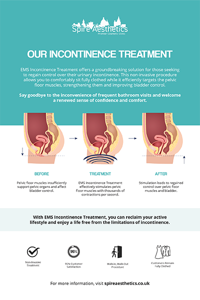 image to show how EMS treatment works for female urinary incontinence Alcester