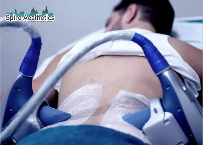 Man having fat freezing treatment done on love handles before a competitions Alcester to create a sculpted look.