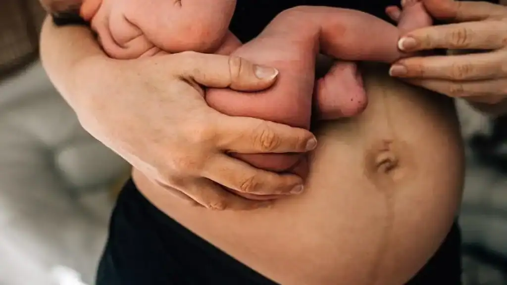 Why Is My Stomach Still Big After Pregnancy Alcester?
