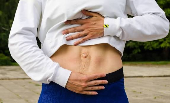 When Could Diastasis Recti Be the Missing Piece of the Puzzle Alcester?